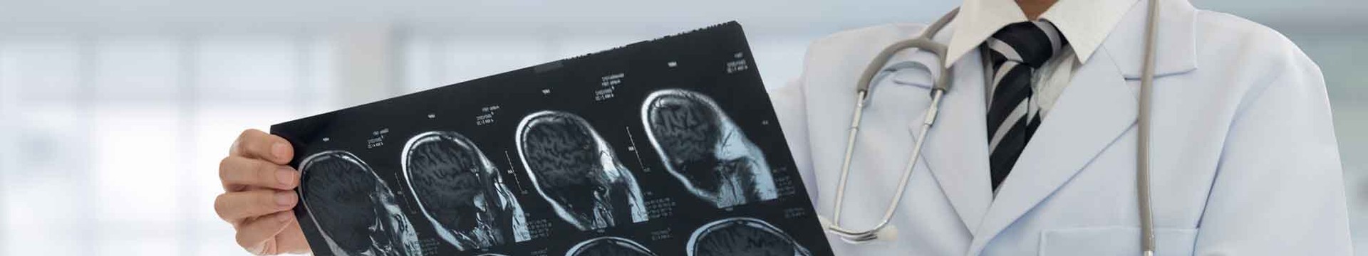 doctor holding an MRI of a brain