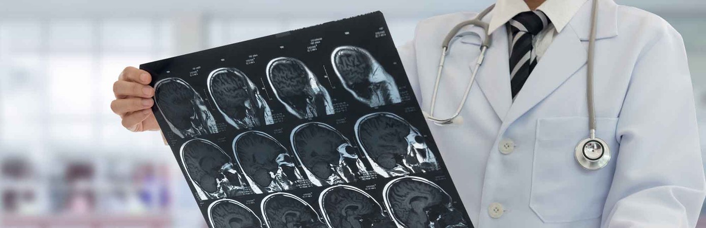 doctor holding an MRI of a brain