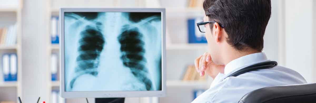 doctor reviewing a chest xray