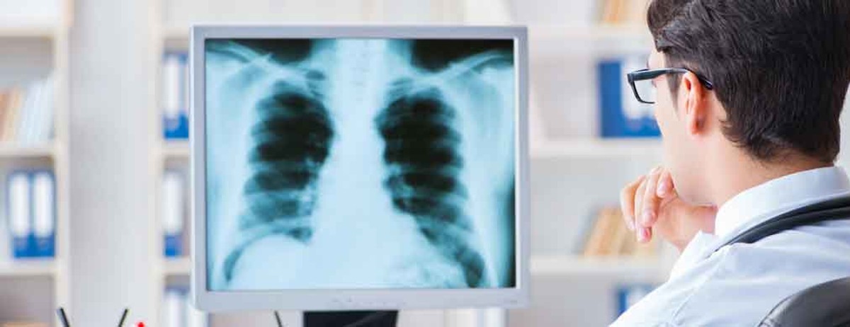 doctor reviewing a chest xray